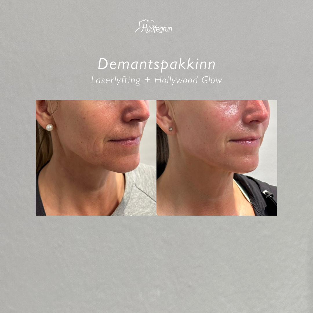 Demantspakkinn