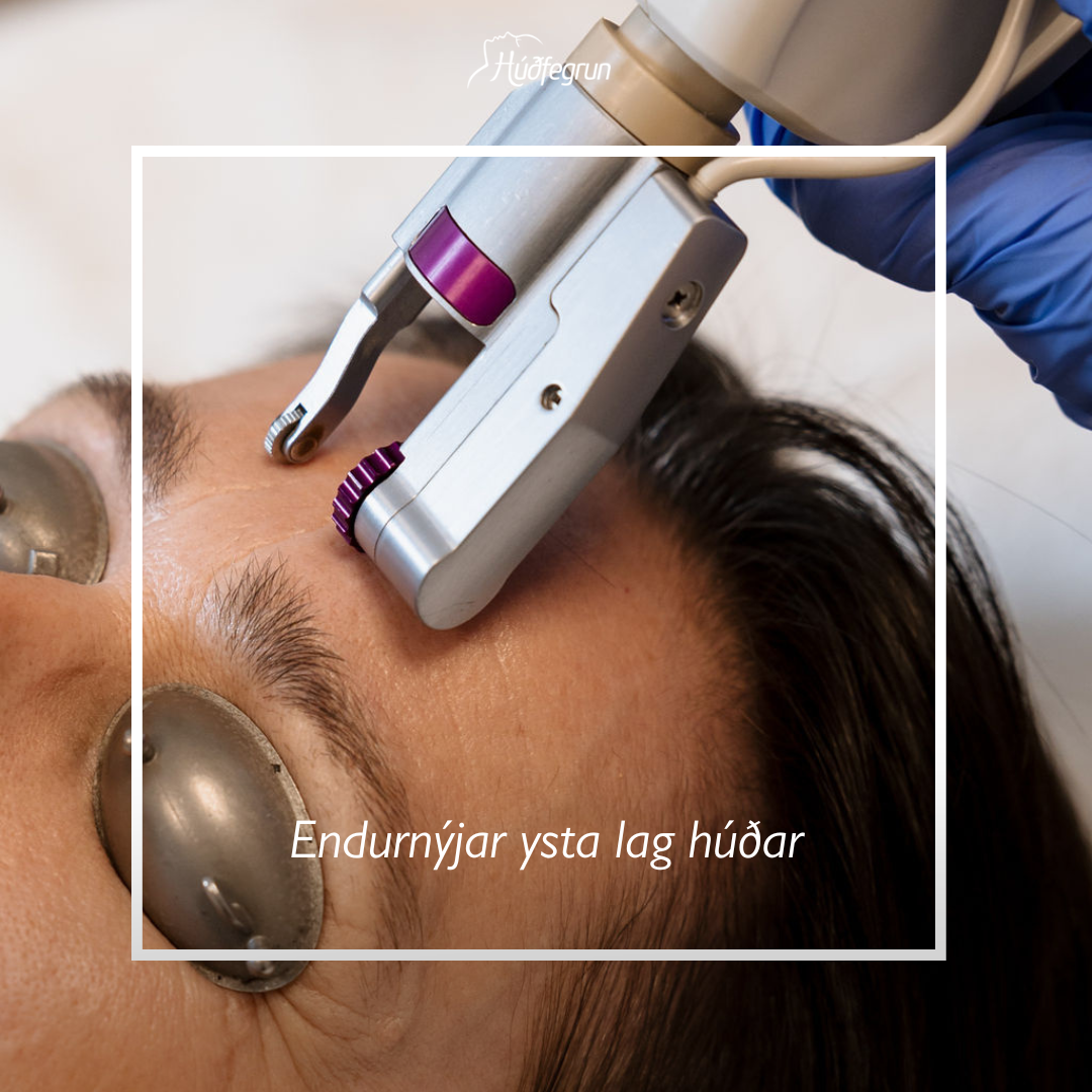 Erbium YAG Laser