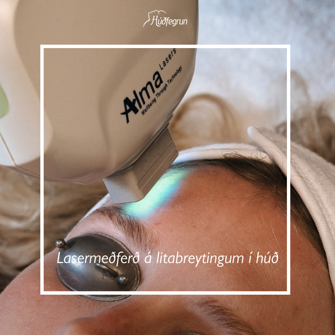 Litabreytingar