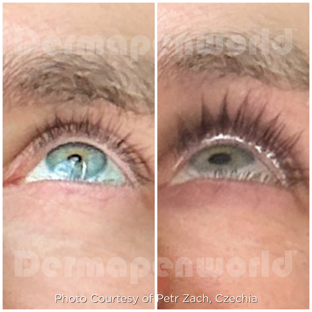EXO-GROW LASH & BROW
