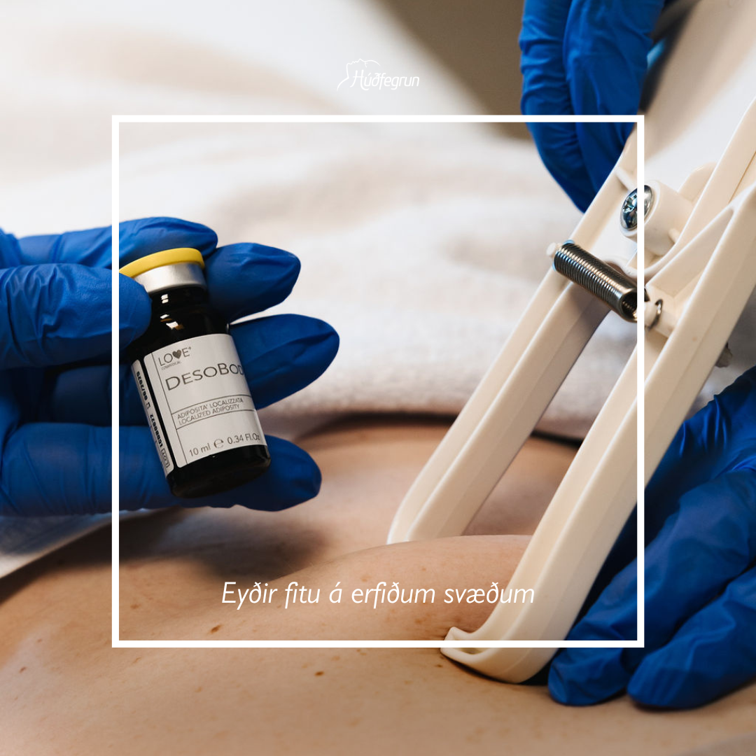 Fitueyðing - Fituleysandi efni