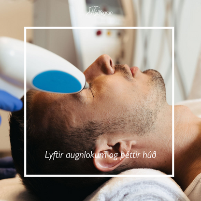 Augnlyfting