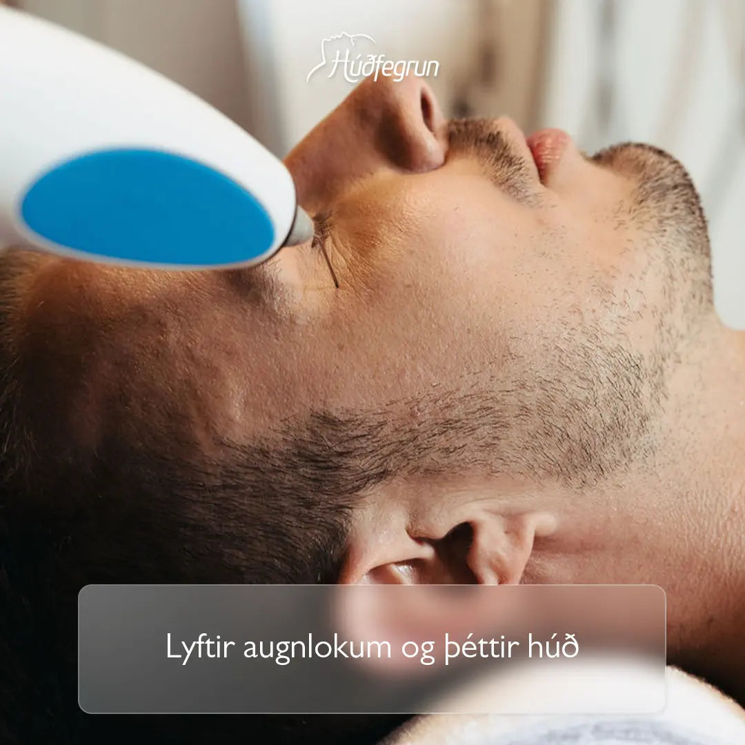 „Augnlyfting án skurðaðgerðar framkvæmda á Húðfegrun – húðþéttandi meðferð fyrir efri augnlok, augnpoka og fínar línur. Mynd notuð í vefverslun Húðfegrunar til að sýna háþróaða augnsnyrtimeðferð.