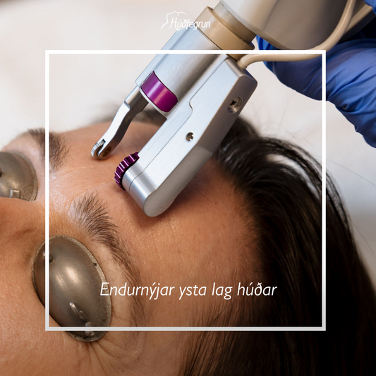 Erbium YAG Laser