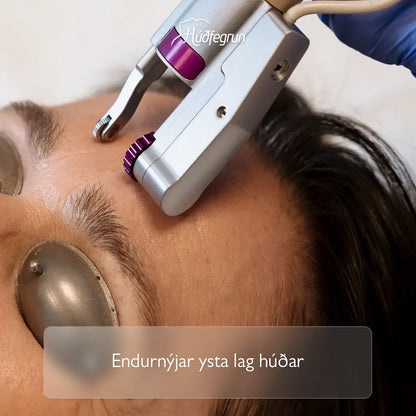 „Erbium YAG Laser hjá Húðfegrun með pixel ER:YAG 2940 tækni sem endurnýjar ysta lag húðar, dregur úr línum, bóluörum og litabreytingum. Mynd notuð í vefverslun Húðfegrunar til að sýna öfluga húðslípandi og kollagenörvandi lasermeðferð.“