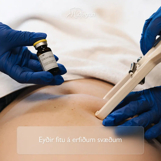 „Fituleysandi sprautumeðferð hjá Húðfegrun með deoxycholic sýru sem brýtur niður fitufrumur á afmörkuðum svæðum án skurðaðgerðar. Mynd notuð í vefverslun Húðfegrunar til að sýna örugga og markvissa fituminnkandi meðferð.“