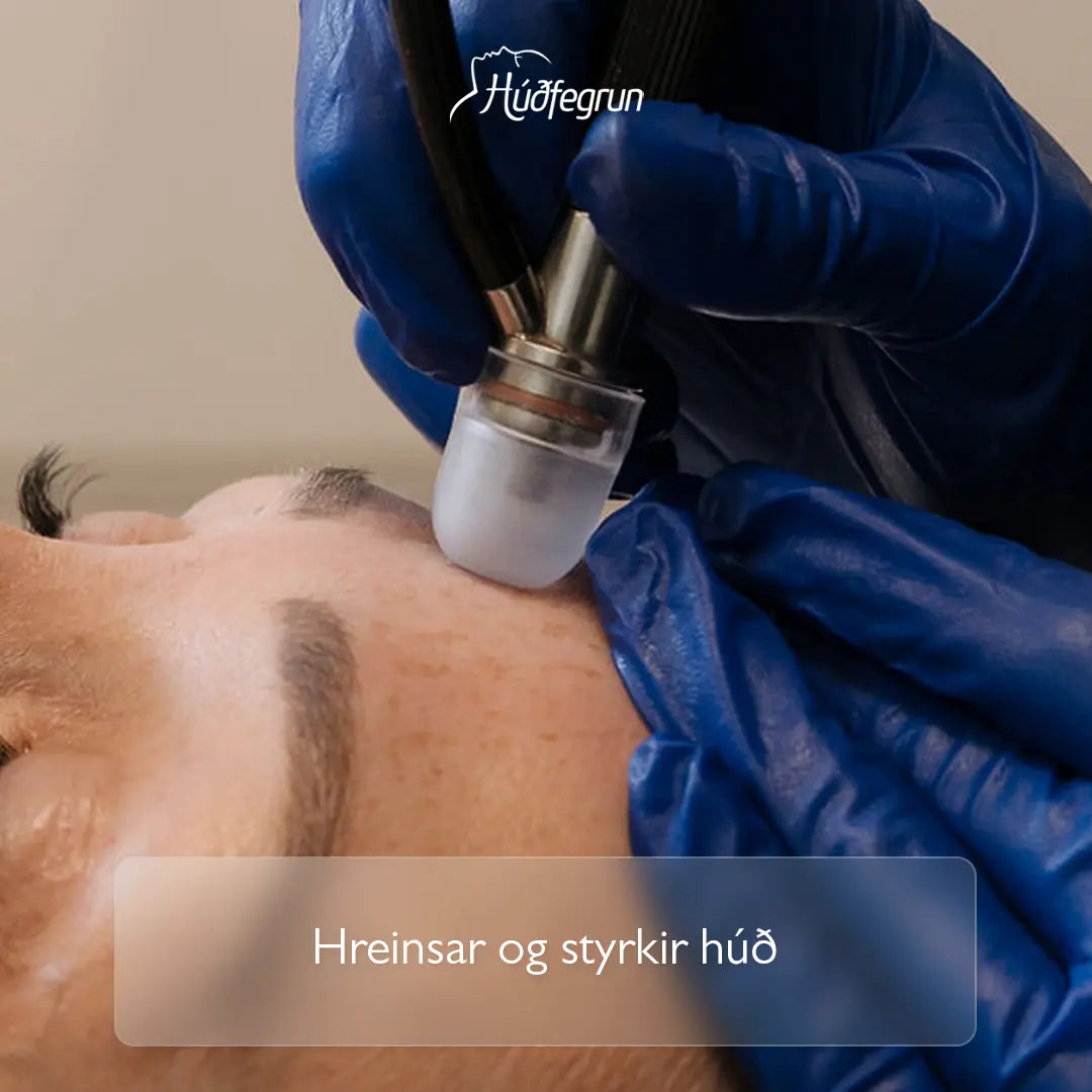 „Húðslípun hjá Húðfegrun með Silk Peel tækni sem fjarlægir dauðar húðfrumur, hreinsar svitaholur og bætir áferð húðar. Mynd notuð í vefverslun Húðfegrunar til að sýna djúphreinsandi og endurnýjandi húðmeðferð.“