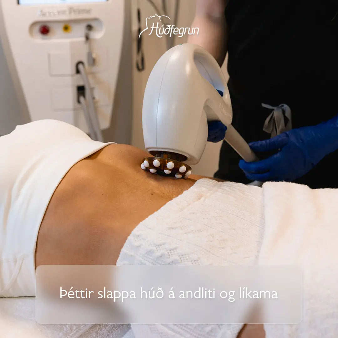 „Húðþétting með radio frequency (RF) hjá Húðfegrun, öflug meðferð sem örvar kollagen, dregur úr slappleika og vinnur á húðslitum. Mynd notuð í vefverslun Húðfegrunar til að sýna húðþéttandi og endurbyggjandi meðferð.“