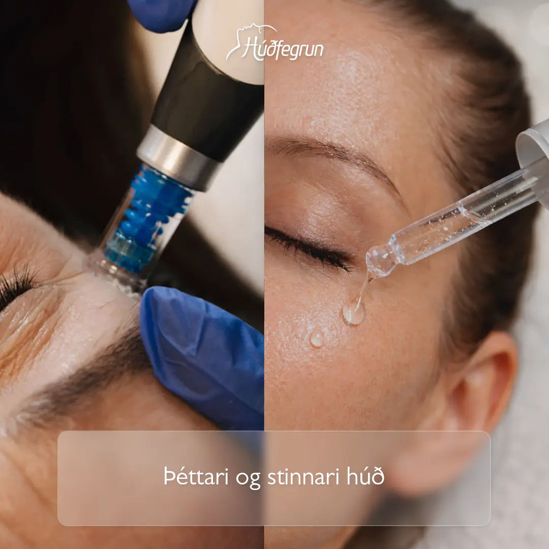 DermaBooster