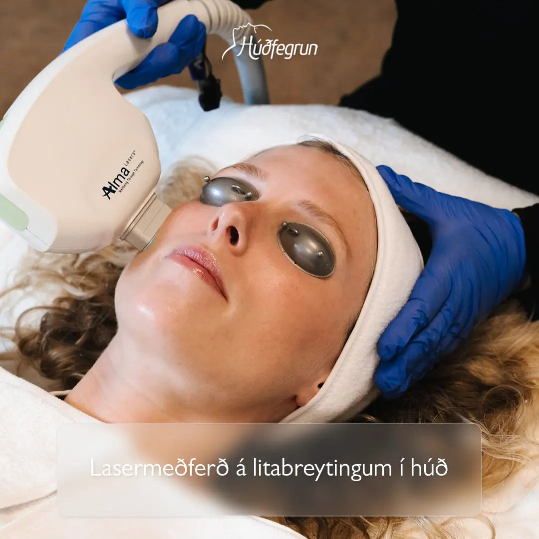 „Lasermeðferð hjá Húðfegrun til að vinna á litabreytingum, sólarskemmdum, brúnum blettum, freknum og öldrunarblettum með nýjustu lasertækni. Mynd notuð í vefverslun Húðfegrunar til að sýna markvissa og örugga ljósmeðferð.“