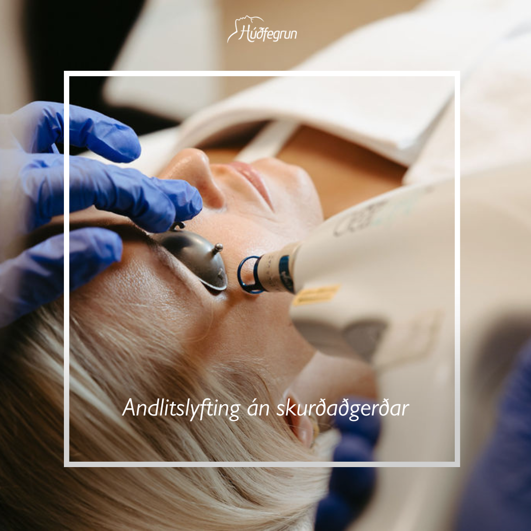 Laserlyfting