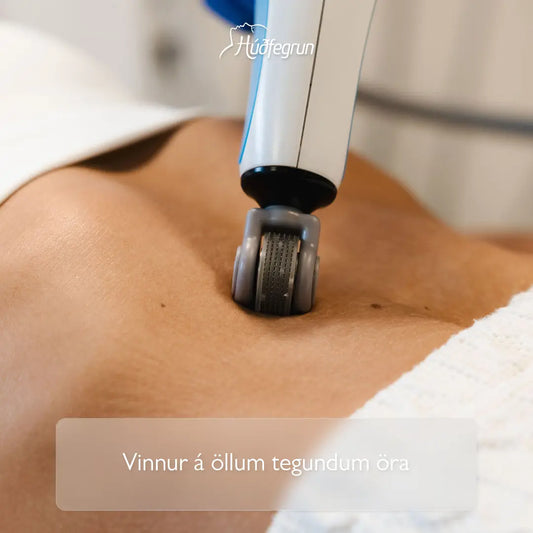 „Meðferð á örum og húðslitum hjá Húðfegrun með háþróaðri radio frequency tækni sem brýtur niður örvef, endurnýjar húð og jafnar lit og áferð. Mynd notuð í vefverslun Húðfegrunar til að sýna markvissa og djúpvirka uppbyggingarmeðferð.“