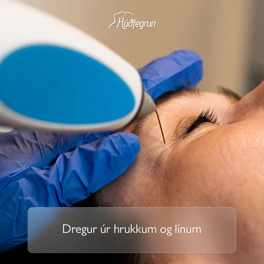 „RF Plasma Hrukkubaninn hjá Húðfegrun, háþróuð meðferð sem dregur úr hrukkum, þéttir húð og örvar kollagen á afmörkuðum svæðum í andliti. Mynd notuð í vefverslun Húðfegrunar til að sýna markvissa og endurnýjandi húðmeðferð.“