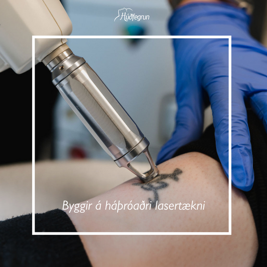 Tattooeyðing