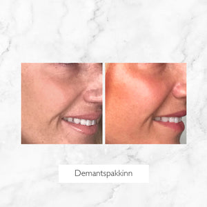 Demantspakkinn