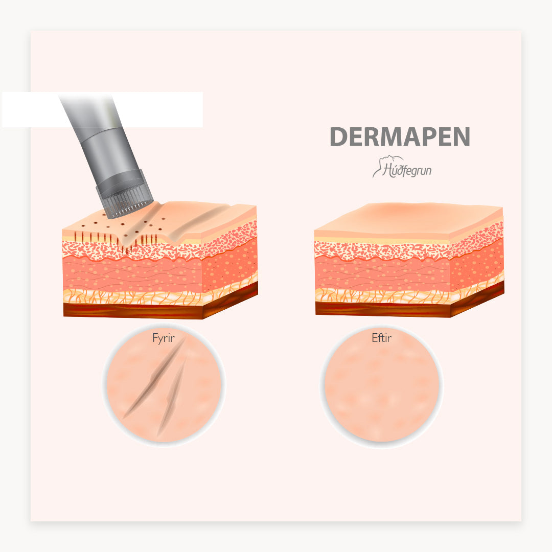 Dermapen